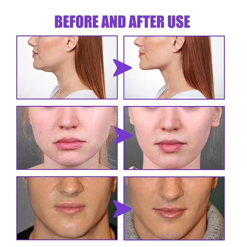Firming Face-lift Slimming Cream V-Shape Slimming Removal Masseter Muscle Double Chin Face Fat Burning Anti-aging Products 30g