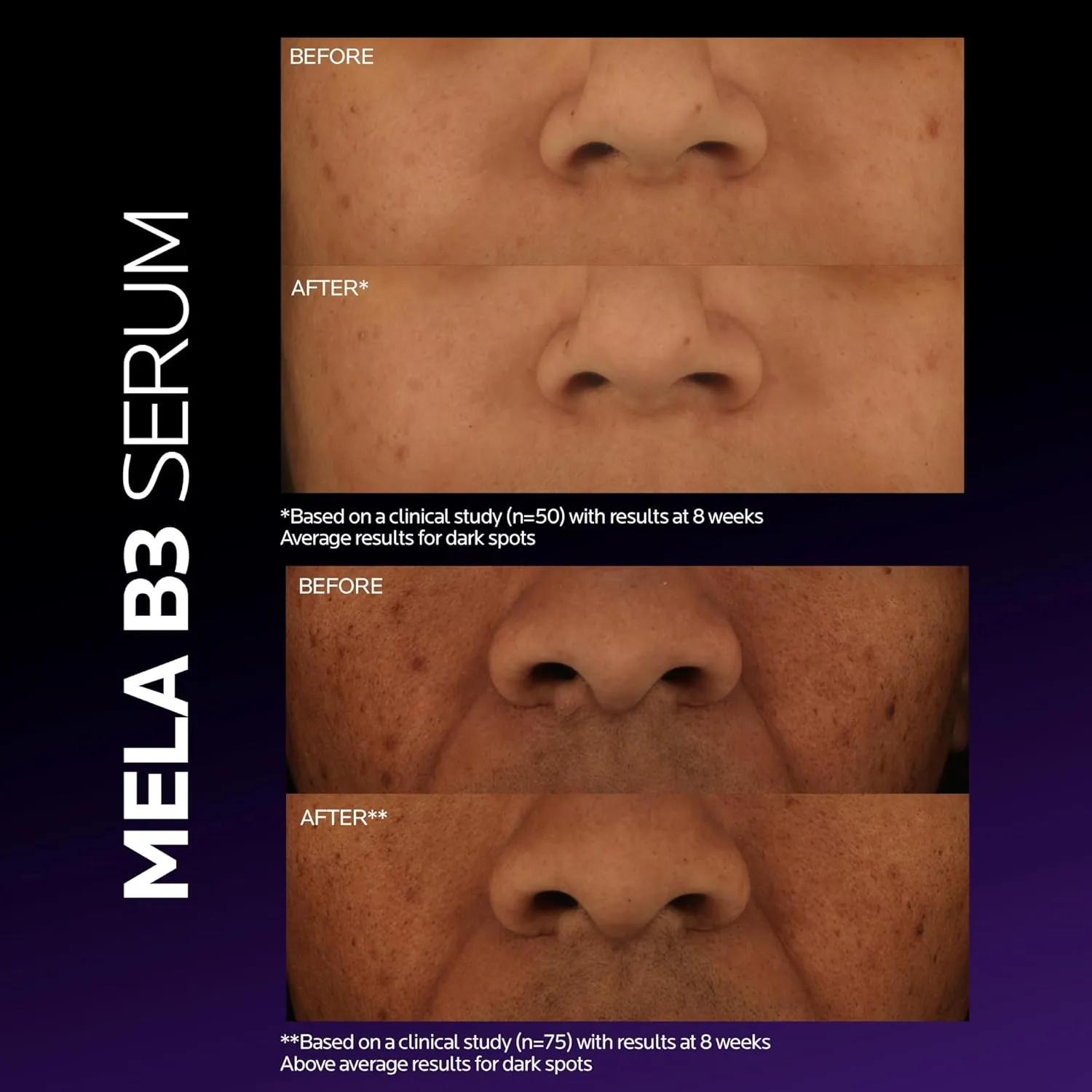 La Roche-Posay Mela B3 Dark Spot Serum